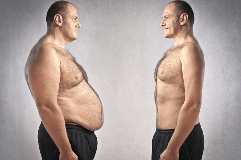 excess weight with prostatitis